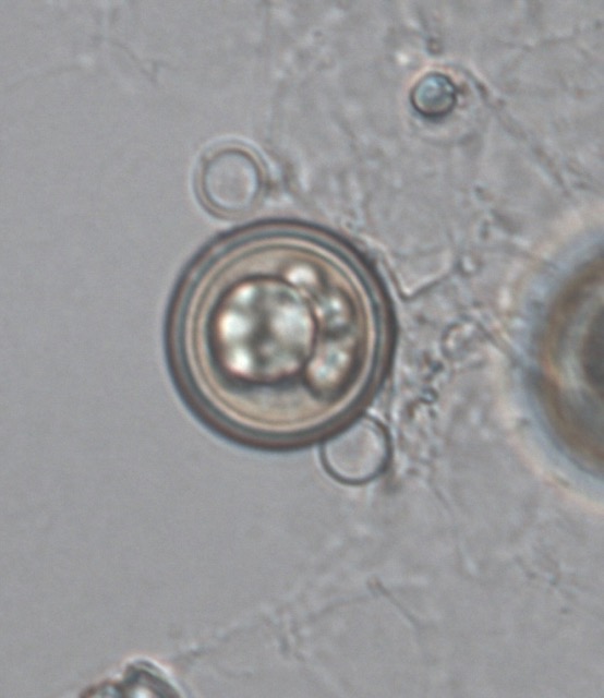 Resting spore formation following sexual reproduction in <i>Chytriomyces hyalinus</i>
