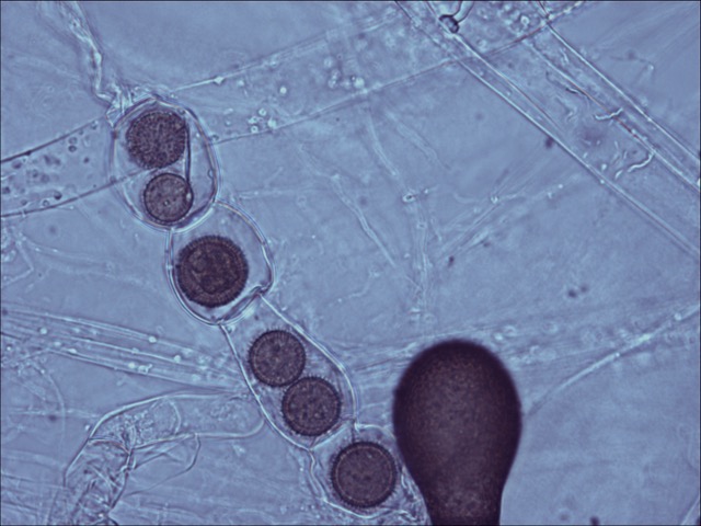 Rozella allomycis parasitizing the water mold Allomyces
