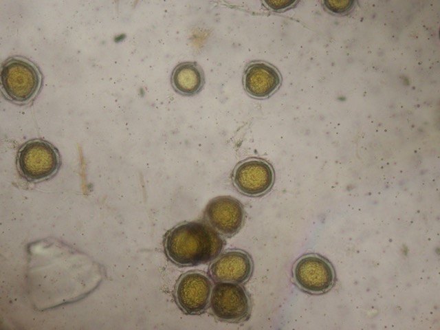 Azygospores of <i>Endogone pisiformis</i>