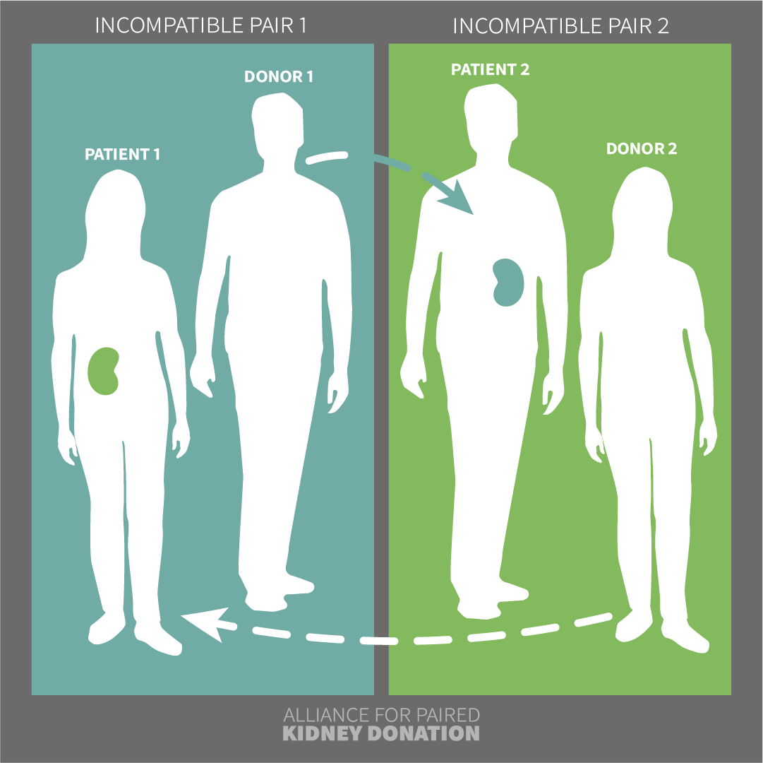 Kidney Paired Donation